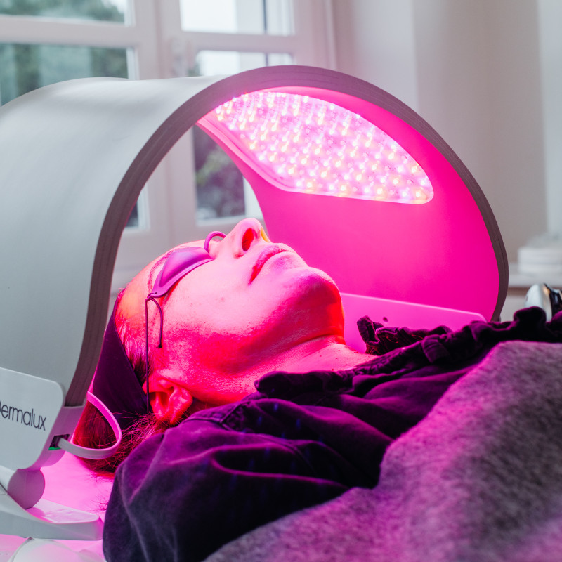 La LED thérapie permet de lutter contre l'inflammation de la peau, de stimuler la synthèse de collagène, de diminuer la prolifération bactérienne et de limiter ainsi les imperfections. 